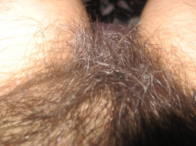 Hairy brunette show pusssy on cam - #20
